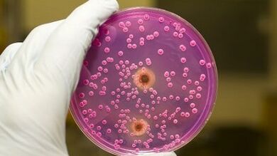 Pathological release in men when excited